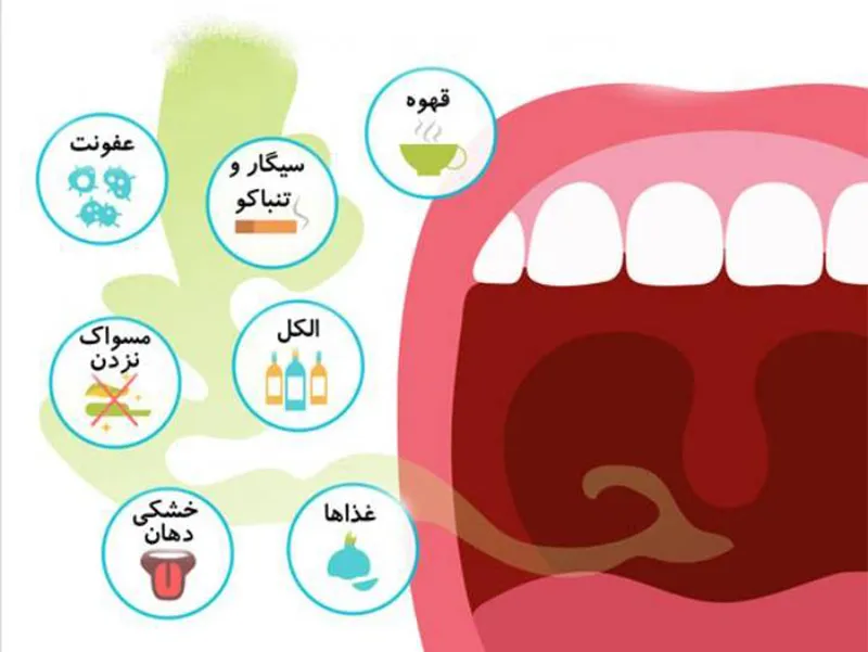 بوی بد دهان